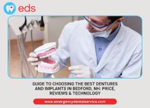 Guide to Choosing the Best Dentures And Implants in Bedford, NH: Price, Reviews & Technology
