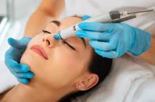 laser facial Delhi