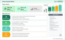 Dental Implant Market