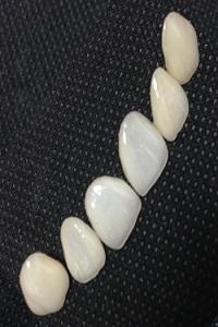 China Dental Lab