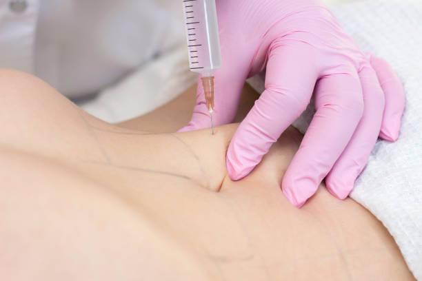 Fat melting injection in Dubai