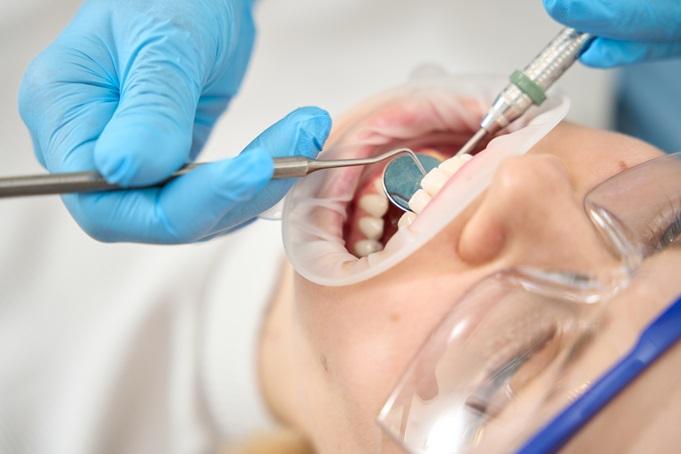 close-up-of-dental-treatment-for-young-woman