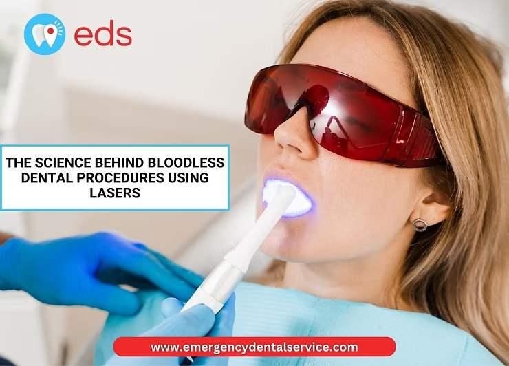 The Science Behind Bloodless Dental Procedures Using Lasers