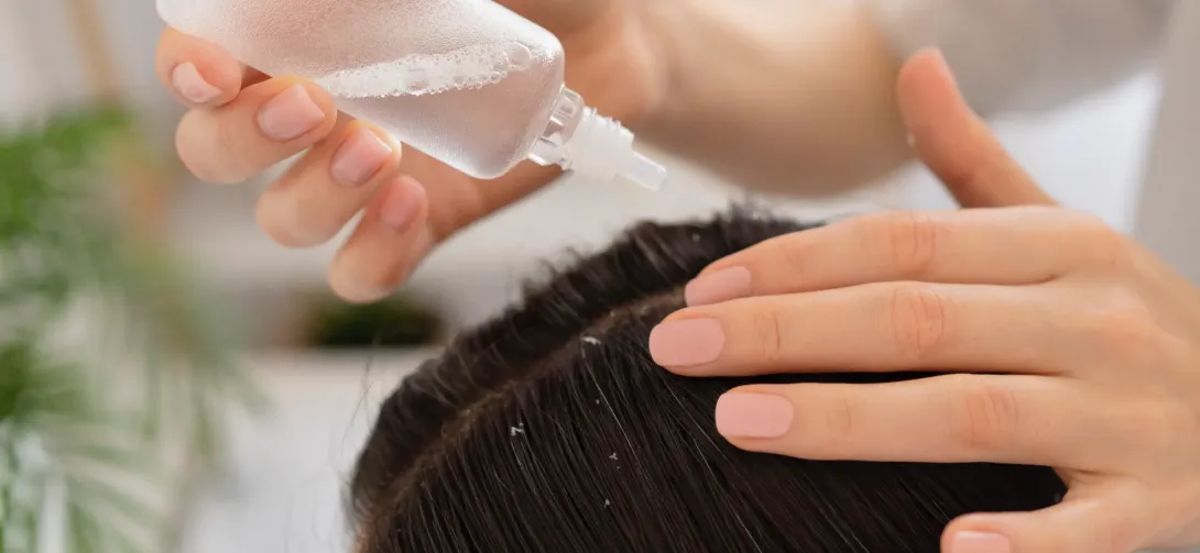 Dandruff Clinic in Ghaziabad