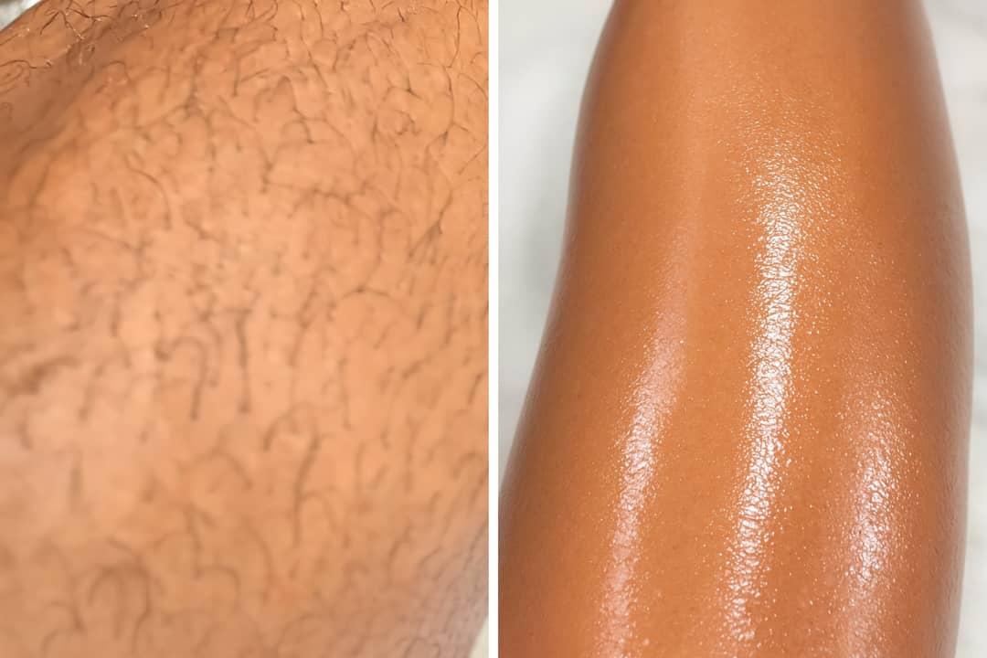 Professional Waxing Treatment in Lagos